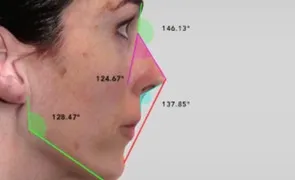 Аппаратная диагностика DermaCheck