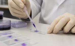 Мазок на цитологию — этап 2