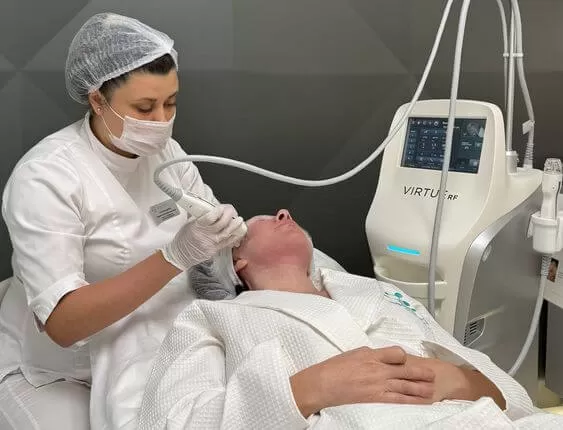 Virtue RF при постакне и рубцах: выровнять рельеф кожи без лазера