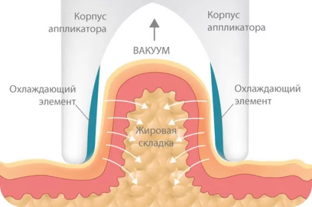 Принцип действия