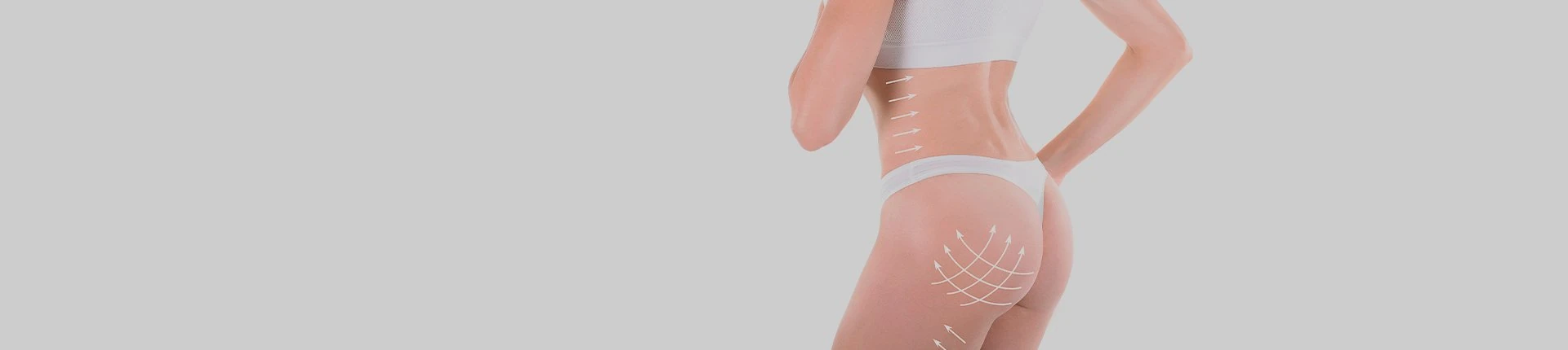 Коррекция тела и целлюлита Vela Shape 3