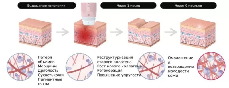 Volnewmer презентация