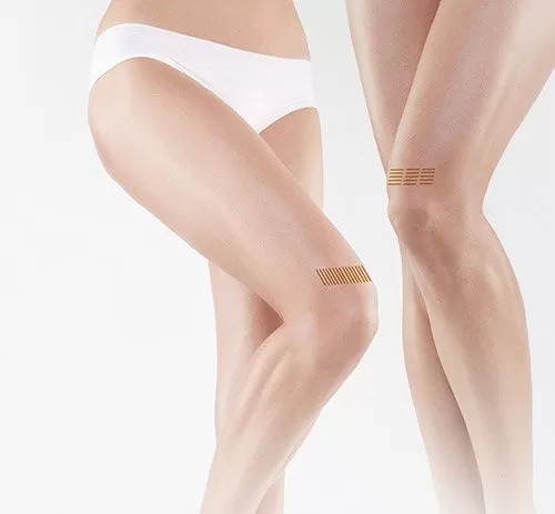 about-ultraformer-body.jpg