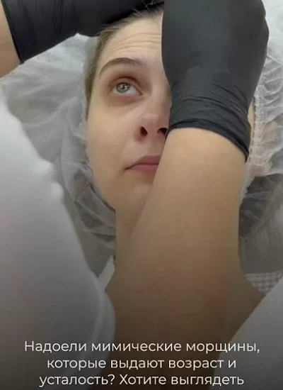 Video29