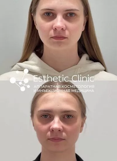 https://vk.ru/clip-211035130_456239741